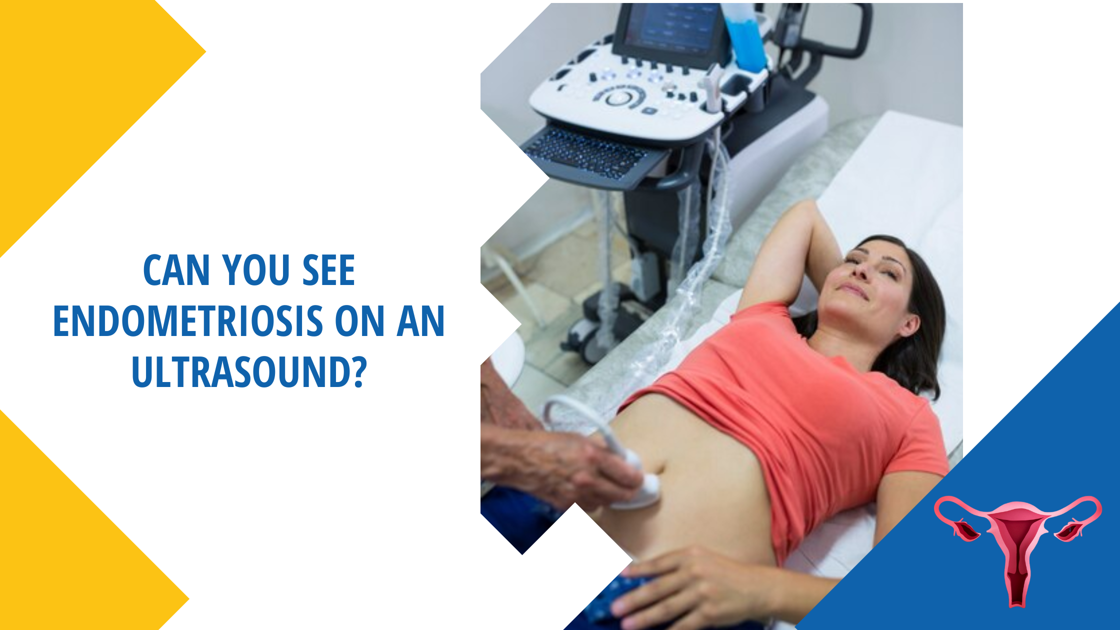 Endometriosis On Ultrasound - Dr Sandesh Kade