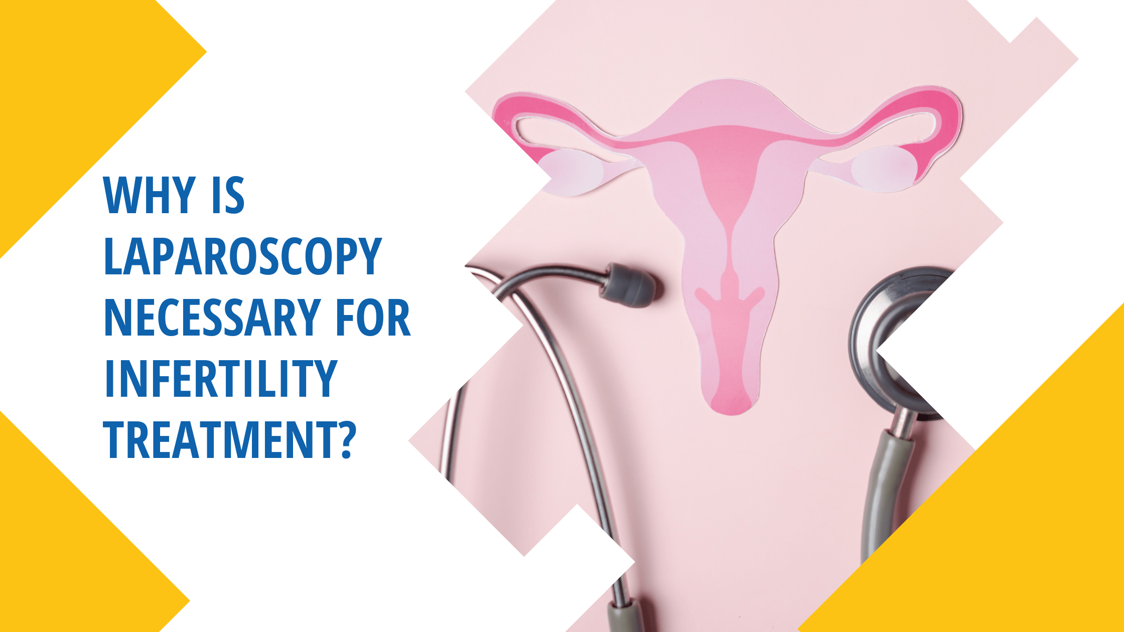 Why is Laparoscopy necessary for Infertility Treatment